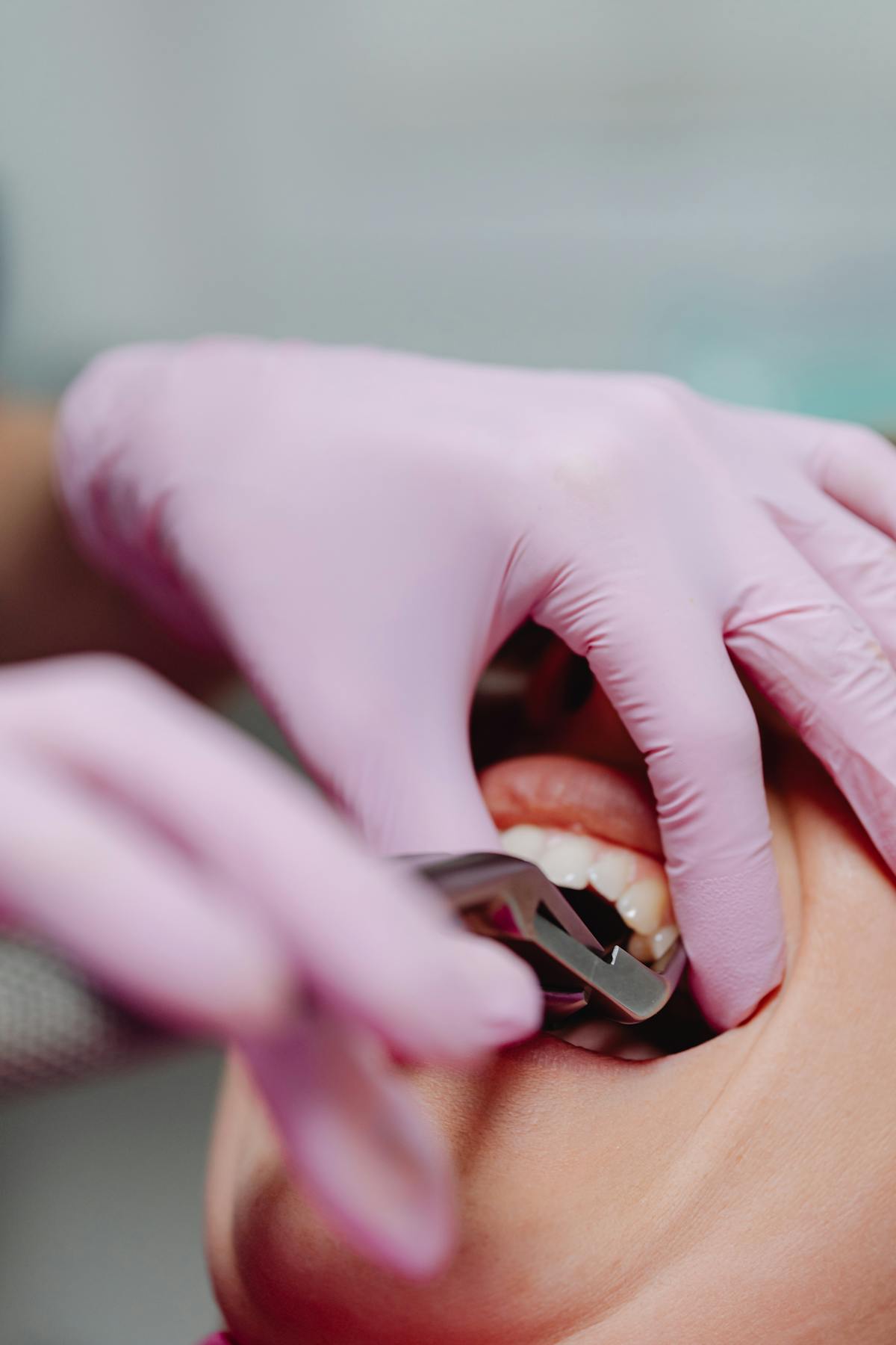 Odontopediatría - Dentista Infantil